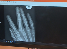 Травматизм