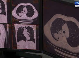 Актуальная тема - Туберкулез