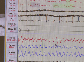 Актуальная тема - Спать много - вредно. Мало - еще хуже. Врачи дают свои рекомендации